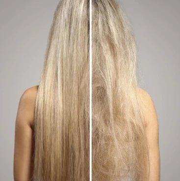 Keratin 
